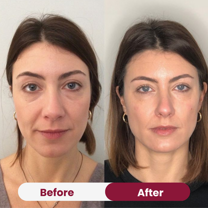 Anti-Wrinkle Collagen Mask