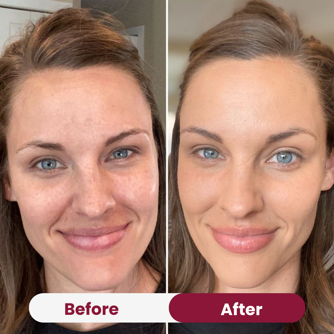 Anti-Wrinkle Collagen Mask