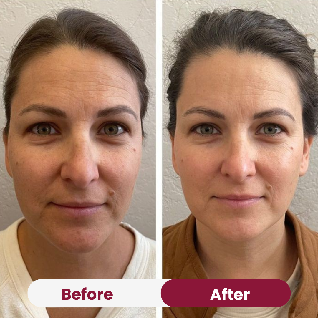 Hydro Cera-Nol Collagen Mask