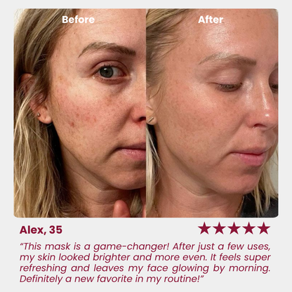 Radiant Niacinamide Real Deep Mask