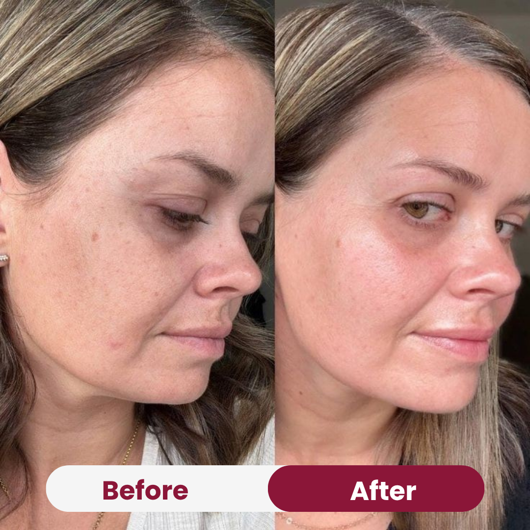 Radiant Niacinamide Real Deep Mask