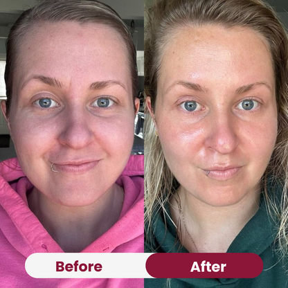 Salmon PDRN Collagen Mask